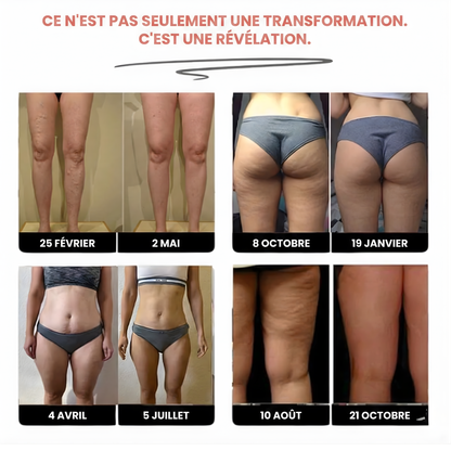 Fitvacker Leggings 3D – Sculptez votre silhouette sans effort