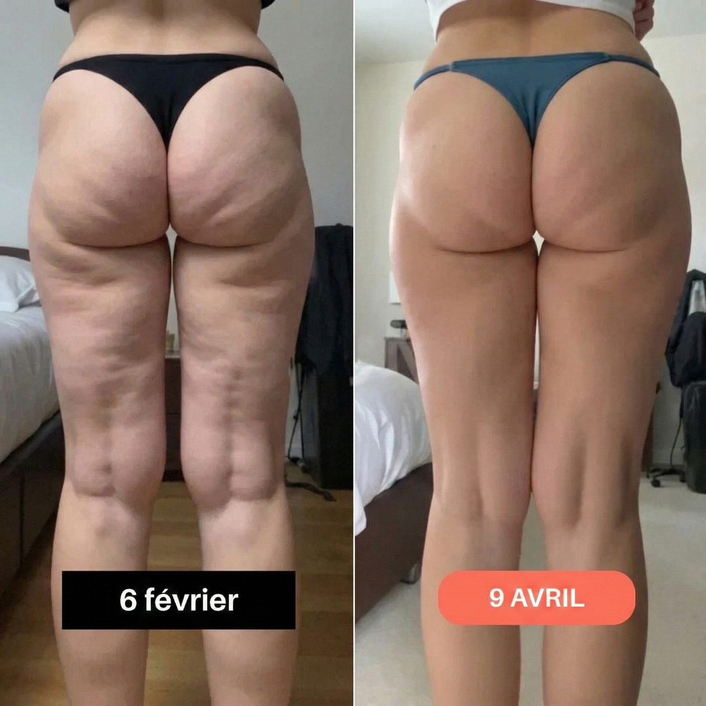 Fitvacker Leggings 3D – Sculptez votre silhouette sans effort