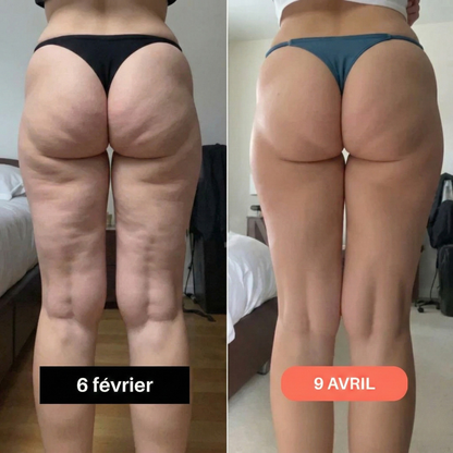 Fitvacker Leggings 3D – Sculptez votre silhouette sans effort